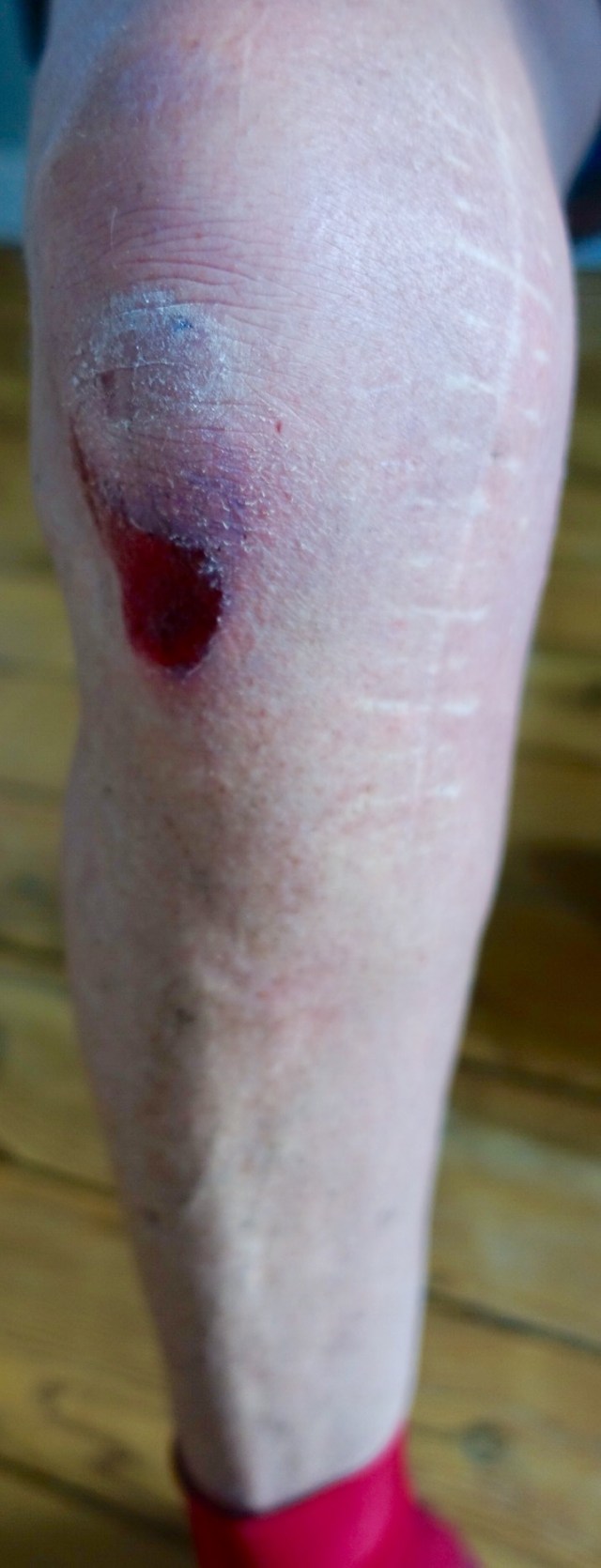 E8E931B8-8EDA-4B93-BB57-CA6312EE299D