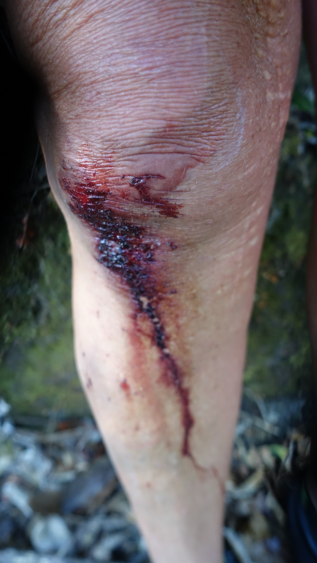 AA04BA35-B4C0-46C9-9C4D-C5E82E24CBB9